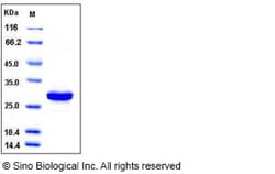 Sino Biological Recombinant Human Carbonic Anhydrase III / CAIII Protein