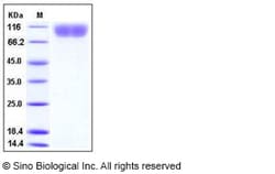 Sino Biological Recombinant Human PDGF beta receptor/PDGFRB Protein (His