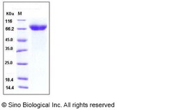 Sino Biological Human ADAM15 / MDC15 Protein (His Tag) 20ug, Quantity: