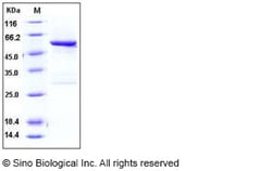 Sino Biological Human SPG21 Protein (GST Tag) 100ug, Quantity: Each of