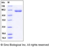 Sino Biological Recombinant Human LBP Protein (His Tag), Quantity: Each
