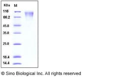 Sino Biological Human CD208 / LAMP3 / DC-LAMP Protein (His Tag) 100ug,