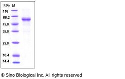 Sino Biological Human RELT / TNFRSF19L Protein (His & Fc Tag) 100ug, Quantity: