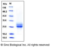 Sino Biological Recombinant Human RELT/TNFRSF19L Protein (His Tag), HPLC-verified,