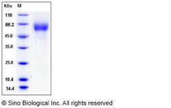 Sino Biological Human FGFR4 / FGF Receptor 4 Protein (His Tag) 50ug, Quantity:
