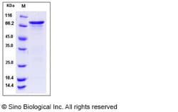 Sino Biological Human CHK1 / CHEK1 Protein (GST Tag) 50ug, Quantity: Each
