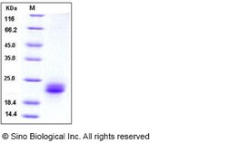 Sino Biological Human VEGF-C Protein (His Tag) 5ug, Quantity: Each of 1