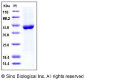 Sino Biological Human ACY1 / Aminoacylase-1 Protein (His Tag) 50ug, Quantity: