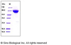 Sino Biological Human BMPR2 / BMPR-II Protein (His & Fc Tag) 200ug, Quantity: