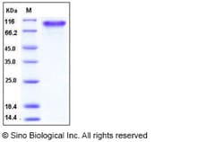 Sino Biological Recombinant Human PDGF alpha receptor/PDGFRA Protein (His
