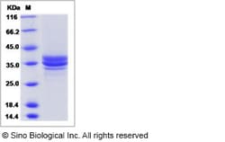 Sino Biological Recombinant Human DC-SIGNR/CD299 Protein (ECD), Quantity: