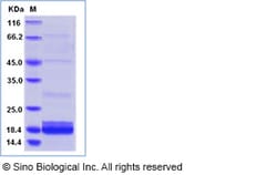 Sino Biological Human Bcl2A1/Bfl-1 protein (His tag) 200ug, Quantity: Each