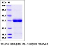 Sino Biological Recombinant Human ANGPTL4 Protein (His Tag), Quantity: