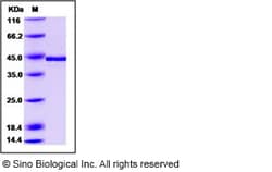 Sino Biological Recombinant Human Transcobalamin II Protein (His Tag),
