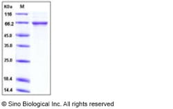 Sino Biological Recombinant Human Beta ig-h3/BIGH3/TGFBI Protein (His Tag),