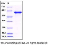 Sino Biological Recombinant Human TC-PTP/PTPN2 Protein (aa 1-314, His &