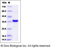 Sino Biological Human PTPN2 / PTPT Protein 100ug, Quantity: Each of 1