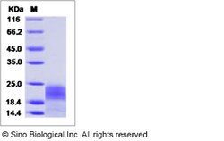 Sino Biological Recombinant Human PDGF-B Protein (His Tag), Quantity: Each