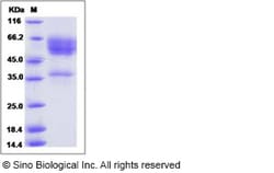 Sino Biological Recombinant Human NKG2D Protein (hFc Tag), HPLC-verified,