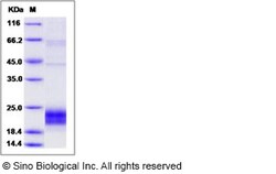 Sino Biological Human NKG2D / CD314 Protein (aa 78-216, His Tag) 100ug,