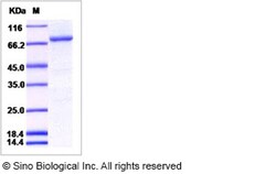 Sino Biological Human Bruton Tyrosine Kinase / BTK Kinase Protein (His