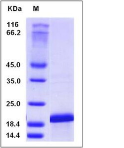 Sino Biological Human IL36B / IL1F8 Protein (His Tag) 20ug, Quantity: Each