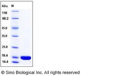 Sino Biological Human IL36B / IL1F8 Protein 50ug, Quantity: Each of 1