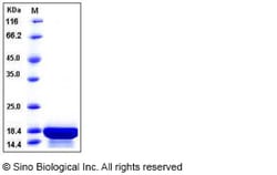 Sino Biological Recombinant Human IL-21 Protein, HPLC-verified, Quantity: