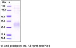Sino Biological Recombinant Human SOST/Sclerostin Protein (His Tag), Quantity: