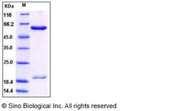 Sino Biological Human PCSK9 / NARC1 (D374Y, V474I, G670E) Protein (His