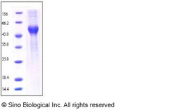 Sino Biological Rat ALK-1 / ACVRL1 Protein (His & Fc Tag) 200ug, Quantity: