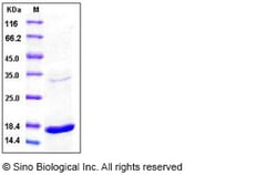 Sino Biological Human TNF-alpha / TNFA Protein 100ug, Quantity: Each of