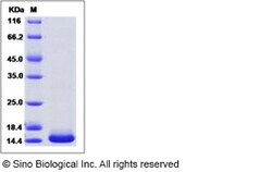 Sino Biological Human XIAP / BIRC4 (BIR3 domain) Protein (His Tag) 100ug,