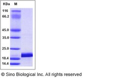 Sino Biological Human IL1F6 / IL36A Protein (His Tag) 20ug, Quantity: Each