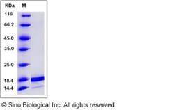 Sino Biological Recombinant Human IL-36 alpha/IL-1F6 Protein (aa 6-158),
