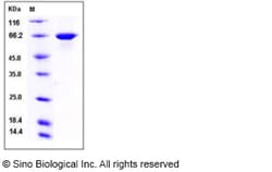 Sino Biological Recombinant Human Harmonin/USH1C Protein (His Tag), Quantity: