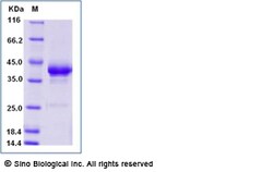 Sino Biological Recombinant Human BCMA Protein (mFc Tag), HPLC-verified,