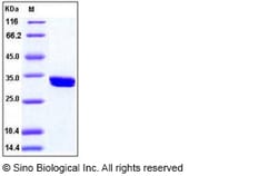 Sino Biological Recombinant Human CDK2 Protein (His Tag), HPLC-verified,