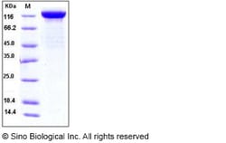 Sino Biological Recombinant Human LIFR Protein (His Tag), HPLC-verified,