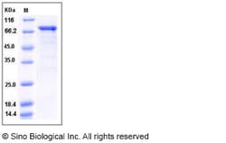 Sino Biological Human CDK16 / PCTAIRE1 / PCTK1 Protein (GST Tag) 50ug,