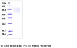 Sino Biological Recombinant Human Fractalkine/CX3CL1 Protein (His Tag),