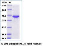 Sino Biological Human Inhibin beta E / INHBE Protein (Fc Tag) 100ug, Quantity: