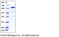 Sino Biological Human CDC37 / CDC37A Protein (GST Tag) 50ug, Quantity: