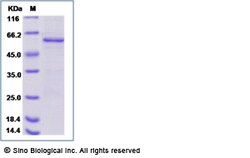 Sino Biological Human Raf-1 / RAF1 Protein (His & GST Tag) 50ug, Quantity: