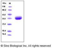 Sino Biological Human AZU1 / Azurocidin 1 / CAP37 Protein (His Tag) 100ug,