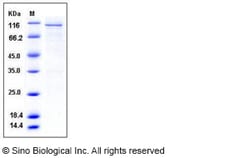 Sino Biological Human CAMK4 / CaMKIV Protein (GST Tag) 50ug, Quantity:
