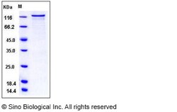 Sino Biological Recombinant Human PKC nu Protein (GST Tag), Quantity: Each