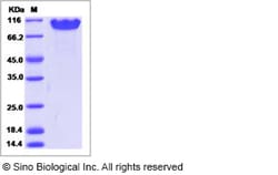 Sino Biological Recombinant Human NCAM-1/CD56 Protein (ECD, His Tag), HPLC-verified,