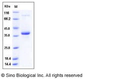 Sino Biological Recombinant Human Epiregulin Protein (hFc Tag), Quantity:
