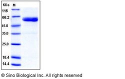 Sino Biological Human ULBP1 / RAET1 / N2DL1 Protein (His & Fc Tag) 100ug,
